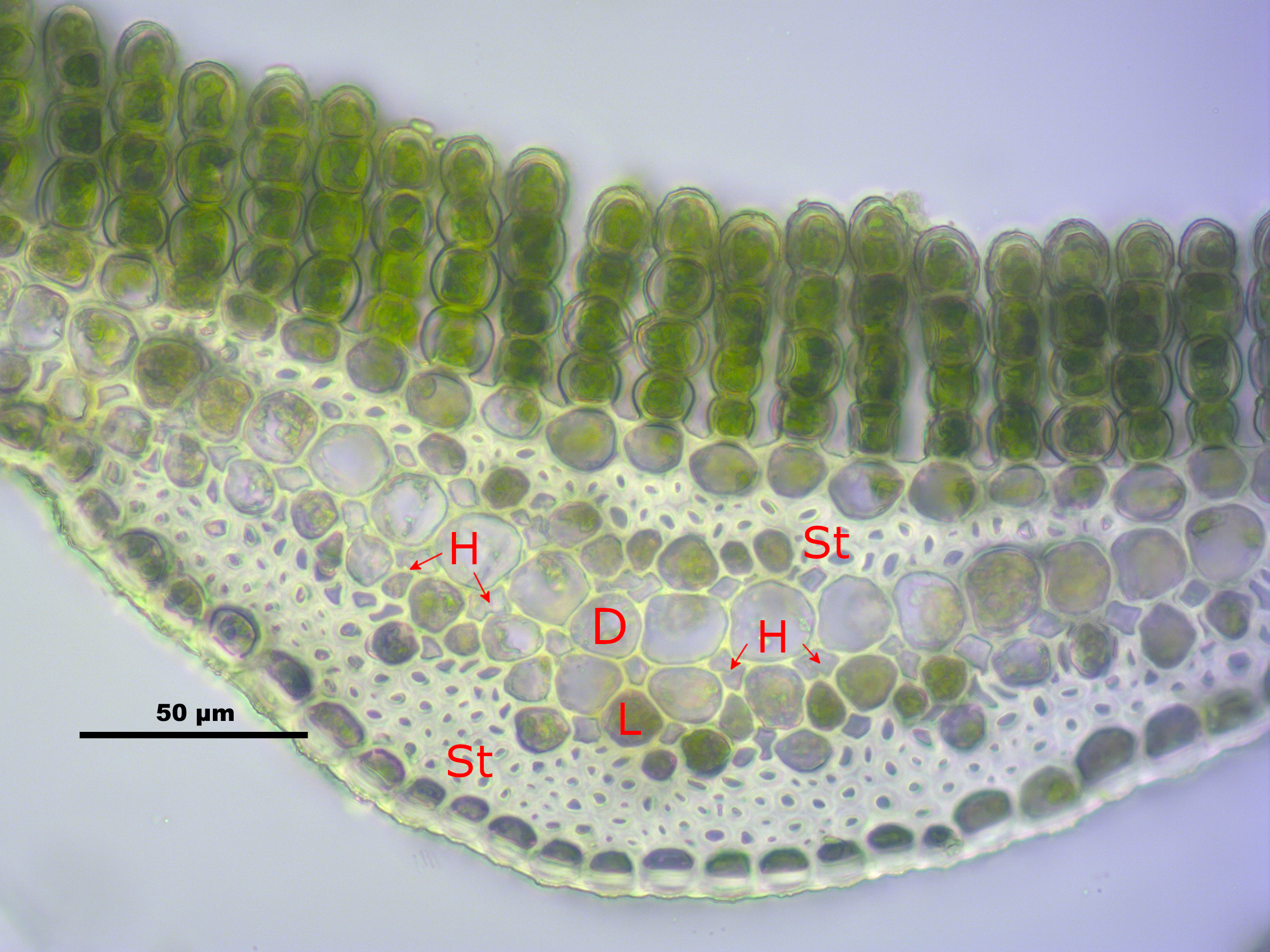 Polytrichastrum_longisetum_%28b,_144747-474405%29_1215%20with%20markings